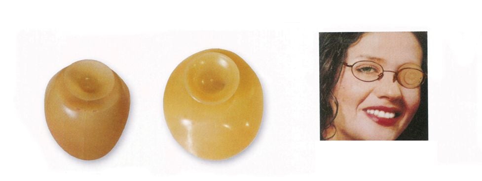 GÖZ KAPAMA LASTİĞİ